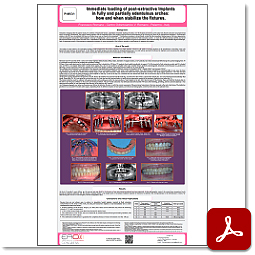 Immediate loading of post-extractive Implants in fully and partially edentulous arches: how and when stabilize the fixtures.